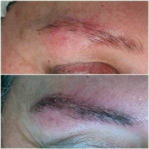 Augenbrauen Haarverdichtung: nach 6 Behandlungen